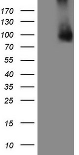 GPNMB / Osteoactivin Antibody - HEK293T cells were transfected with the pCMV6-ENTRY control. (Left lane) or pCMV6-ENTRY GPNMB. (Right lane) cDNA for 48 hrs and lysed