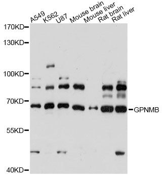 GPNMB / Osteoactivin Antibody - Western blot analysis of extracts of various cell lines, using GPNMB antibody at 1:3000 dilution. The secondary antibody used was an HRP Goat Anti-Rabbit IgG (H+L) at 1:10000 dilution. Lysates were loaded 25ug per lane and 3% nonfat dry milk in TBST was used for blocking. An ECL Kit was used for detection and the exposure time was 30s.