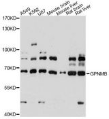 GPNMB / Osteoactivin Antibody - Western blot analysis of extracts of various cell lines, using GPNMB antibody at 1:3000 dilution. The secondary antibody used was an HRP Goat Anti-Rabbit IgG (H+L) at 1:10000 dilution. Lysates were loaded 25ug per lane and 3% nonfat dry milk in TBST was used for blocking. An ECL Kit was used for detection and the exposure time was 30s.