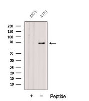 GPNMB / Osteoactivin Antibody - Western blot analysis of extracts of A375 cells using GPNMB antibody. The lane on the left was treated with blocking peptide.