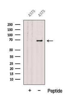 GPNMB / Osteoactivin Antibody - Western blot analysis of extracts of A375 cells using GPNMB antibody. The lane on the left was treated with blocking peptide.