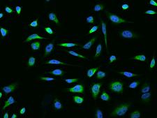 GPNMB / Osteoactivin Antibody - Immunofluorescence staining of GPNMB in HeLa cells. Cells were fixed with 4% PFA, permeabilzed with 0.3% Triton X-100 in PBS, blocked with 10% serum, and incubated with rabbit anti-Human GPNMB polyclonal antibody (dilution ratio 1:200) at 4°C overnight. Then cells were stained with the Alexa Fluor 488-conjugated Goat Anti-rabbit IgG secondary antibody (green) and counterstained with DAPI (blue). Positive staining was localized to Cytoplasm.
