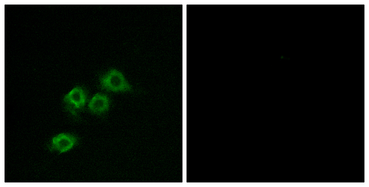 GPR1 Antibody - Immunofluorescence analysis of MCF7 cells, using GPR1 Antibody. The picture on the right is blocked with the synthesized peptide.