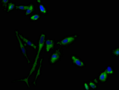 GPR1 Antibody - Immunofluorescence staining of Hela cells at a dilution of 1:100, counter-stained with DAPI. The cells were fixed in 4% formaldehyde, permeabilized using 0.2% Triton X-100 and blocked in 10% normal Goat Serum. The cells were then incubated with the antibody overnight at 4 °C.The secondary antibody was Alexa Fluor 488-congugated AffiniPure Goat Anti-Rabbit IgG (H+L) .