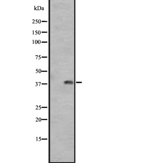 GPR1 Antibody - Western blot analysis of GPR1 expression in A431 whole cells lysate. The lane on the left is treated with the antigen-specific peptide.