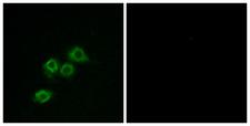 GPR1 Antibody - Peptide - + Immunofluorescence analysis of MCF-7 cells, using GPR1 antibody.