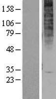 GPR1 Protein - Western validation with an anti-DDK antibody * L: Control HEK293 lysate R: Over-expression lysate