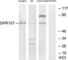 GPR107 / LUSTR1 Antibody - Western blot analysis of lysates from HUVEC, Jurkat, and COLO205 cells, using GPR107 Antibody. The lane on the right is blocked with the synthesized peptide.