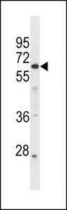 GPR107 / LUSTR1 Antibody - GPR107 Antibody western blot of A549 cell line lysates (35 ug/lane). The GPR107 antibody detected the GPR107 protein (arrow).