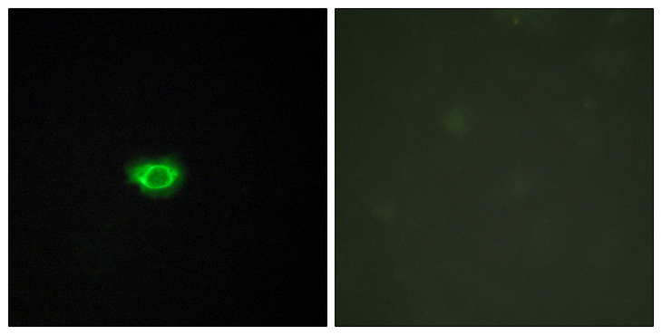 GPR108 Antibody - Immunofluorescence analysis of HUVEC cells, using GPR108 Antibody. The picture on the right is blocked with the synthesized peptide.