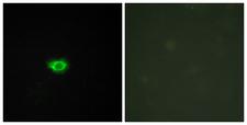 GPR108 Antibody - Immunofluorescence analysis of HUVEC cells, using GPR108 Antibody. The picture on the right is blocked with the synthesized peptide.