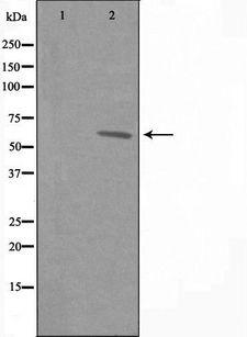 GPR108 Antibody - Western blot analysis of extracts of A549 cells using GP108 antibody. The lane on the left is treated with the antigen-specific peptide.