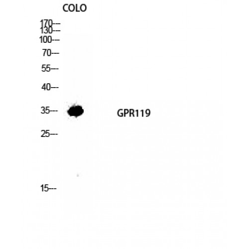 GPR119 Antibody - Western blot of GPR119 antibody