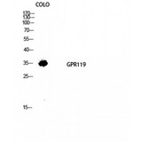 GPR119 Antibody - Western blot of GPR119 antibody