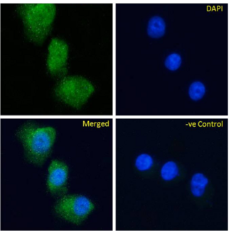 GPR119 Antibody - IF staining of HeLa cells.
