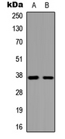 GPR119 Antibody - Western blot analysis of GPR119 expression in HeLa (A); COLO205 (B) whole cell lysates.