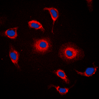 GPR119 Antibody - Immunofluorescent analysis of GPR119 staining in HeLa cells. Formalin-fixed cells were permeabilized with 0.1% Triton X-100 in TBS for 5-10 minutes and blocked with 3% BSA-PBS for 30 minutes at room temperature. Cells were probed with the primary antibody in 3% BSA-PBS and incubated overnight at 4 deg C in a humidified chamber. Cells were washed with PBST and incubated with a DyLight 594-conjugated secondary antibody (red) in PBS at room temperature in the dark. DAPI was used to stain the cell nuclei (blue).