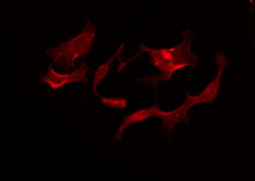 GPR119 Antibody - Staining HeLa cells by IF/ICC. The samples were fixed with PFA and permeabilized in 0.1% Triton X-100, then blocked in 10% serum for 45 min at 25°C. The primary antibody was diluted at 1:200 and incubated with the sample for 1 hour at 37°C. An Alexa Fluor 594 conjugated goat anti-rabbit IgG (H+L) Ab, diluted at 1/600, was used as the secondary antibody.