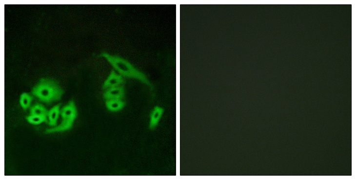 GPR12 Antibody - Immunofluorescence analysis of A549 cells, using GPR12 Antibody. The picture on the right is blocked with the synthesized peptide.