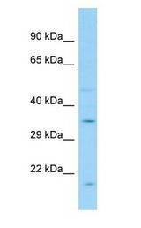 GPR12 Antibody - GPR12 antibody Western Blot of Fetal Liver.  This image was taken for the unconjugated form of this product. Other forms have not been tested.