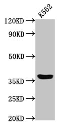 GPR12 Antibody - Positive Western Blot detected in K562 whole cell lysate. All lanes: GPR12 antibody at 2 µg/ml Secondary Goat polyclonal to rabbit IgG at 1/50000 dilution. Predicted band size: 37 KDa. Observed band size: 37 KDa