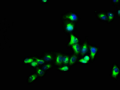 GPR12 Antibody - Immunofluorescence staining of Hela cells with GPR12 Antibody at 1:66, counter-stained with DAPI. The cells were fixed in 4% formaldehyde, permeabilized using 0.2% Triton X-100 and blocked in 10% normal Goat Serum. The cells were then incubated with the antibody overnight at 4°C. The secondary antibody was Alexa Fluor 488-congugated AffiniPure Goat Anti-Rabbit IgG(H+L).