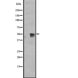GPR12 Antibody - Western blot analysis of GPR12 expression in HEK293 cells. The lane on the left is treated with the antigen-specific peptide.