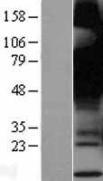 GPR12 Protein - Western validation with an anti-DDK antibody * L: Control HEK293 lysate R: Over-expression lysate