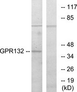 GPR132 / G2A Antibody - Western blot analysis of lysates from COS7 cells, using GPR132 Antibody. The lane on the right is blocked with the synthesized peptide.