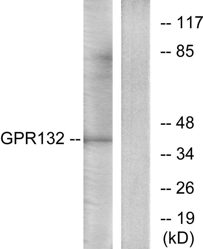 GPR132 / G2A Antibody - Western blot analysis of lysates from Jurkat cells, using GPR132 Antibody. The lane on the right is blocked with the synthesized peptide.