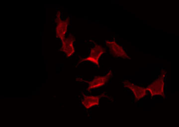 GPR132 / G2A Antibody - Staining HeLa cells by IF/ICC. The samples were fixed with PFA and permeabilized in 0.1% Triton X-100, then blocked in 10% serum for 45 min at 25°C. The primary antibody was diluted at 1:200 and incubated with the sample for 1 hour at 37°C. An Alexa Fluor 594 conjugated goat anti-rabbit IgG (H+L) Ab, diluted at 1/600, was used as the secondary antibody.