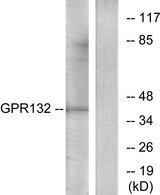 GPR132 / G2A Antibody - Western blot analysis of extracts from Jurkat cells, using GPR132 antibody.
