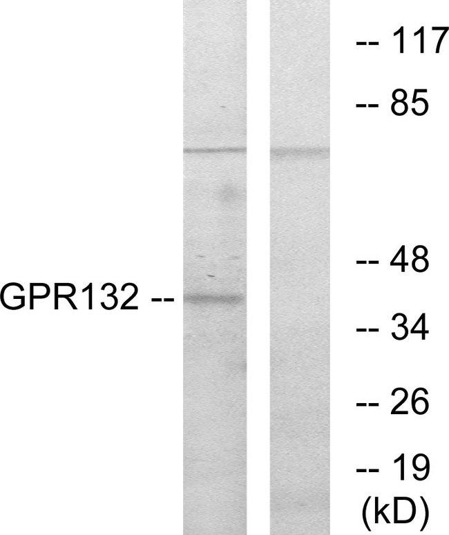 GPR132 / G2A Antibody - Western blot analysis of extracts from COS-7 cells, using GPR132 antibody.