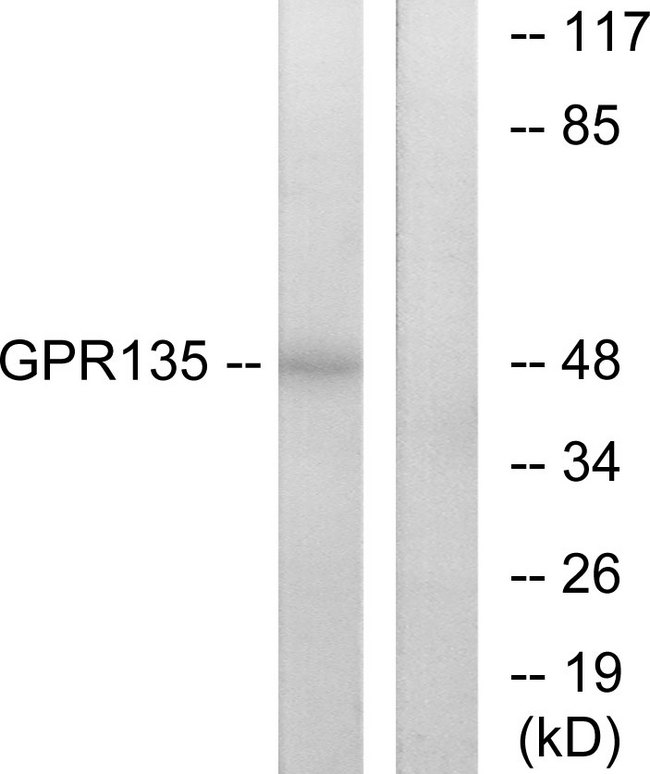 GPR135 Antibody - Western blot analysis of lysates from NIH/3T3 cells, using GPR135 Antibody. The lane on the right is blocked with the synthesized peptide.