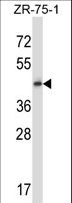 GPR137 Antibody - GPR137 Antibody western blot of ZR-75-1 cell line lysates (35 ug/lane). The GPR137 antibody detected the GPR137 protein (arrow).