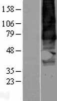 GPR137B Protein - Western validation with an anti-DDK antibody * L: Control HEK293 lysate R: Over-expression lysate
