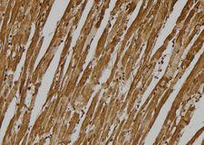 GPR137C / TM7SF1L2 Antibody - 1:100 staining mouse heart tissue by IHC-P. The sample was formaldehyde fixed and a heat mediated antigen retrieval step in citrate buffer was performed. The sample was then blocked and incubated with the antibody for 1.5 hours at 22°C. An HRP conjugated goat anti-rabbit antibody was used as the secondary.
