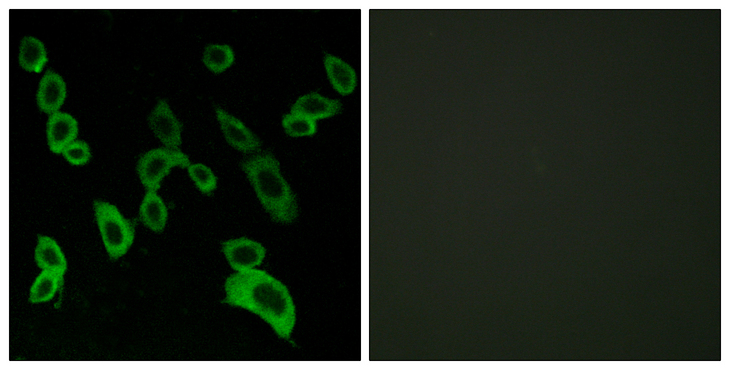 GPR139 Antibody - Immunofluorescence analysis of LOVO cells, using GPR139 Antibody. The picture on the right is blocked with the synthesized peptide.