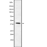 GPR139 Antibody - Western blot analysis GPR139 using HeLa whole cells lysates