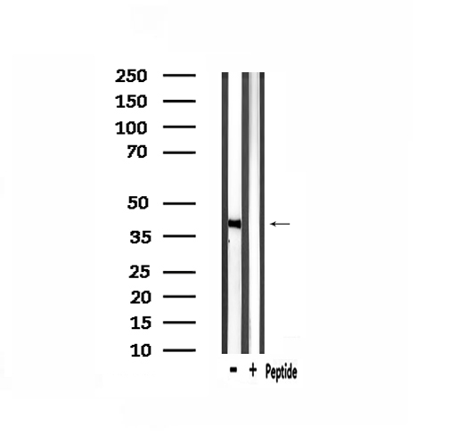 GPR139 Antibody - Western blot analysis of extracts of mouse liver tissue using GPR139 antibody.