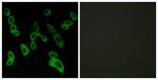 GPR139 Antibody - Peptide - + Immunofluorescence analysis of LOVO cells, using GPR139 antibody.