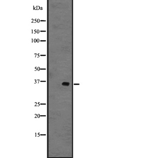 GPR141 Antibody - Western blot analysis of GPR141 expression in 721_B whole cells lysate. The lane on the left is treated with the antigen-specific peptide.