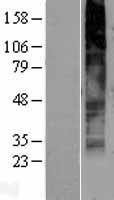 GPR141 Protein - Western validation with an anti-DDK antibody * L: Control HEK293 lysate R: Over-expression lysate