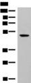 GPR142 Antibody - Western blot analysis of Hela cell lysate  using GPR142 Polyclonal Antibody at dilution of 1:400