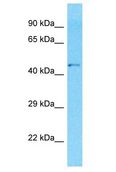 GPR142 Antibody - GPR142 antibody Western Blot of MDA-MB-435s. Antibody dilution: 1 ug/ml.  This image was taken for the unconjugated form of this product. Other forms have not been tested.