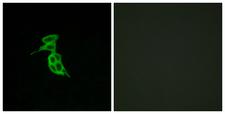 GPR143 Antibody - Immunofluorescence analysis of LOVO cells, using GPR143 Antibody. The picture on the right is blocked with the synthesized peptide.