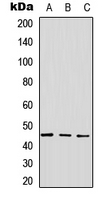 GPR143 Antibody - Western blot analysis of GPR143 expression in A549 (A); NS-1 (B); PC12 (C) whole cell lysates.
