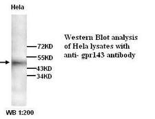 GPR143 Antibody