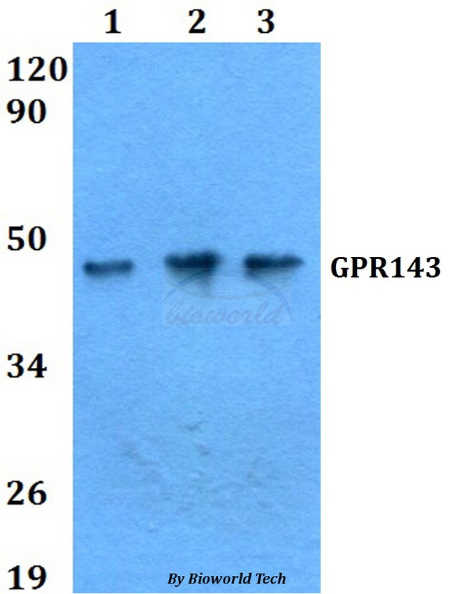 GPR143 Antibody - Western blot of GPR143 antibody at 1:500 dilution. Lane 1: A549 whole cell lysate. Lane 2: sp2/0 whole cell lysate. Lane 3: PC12 whole cell lysate.