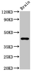 GPR143 Antibody - Positive Western Blot detected in Rat brain tissue. All lanes: GPR14 antibody at 3.7 µg/ml Secondary Goat polyclonal to rabbit IgG at 1/50000 dilution. Predicted band size: 44 KDa. Observed band size: 44 KDa